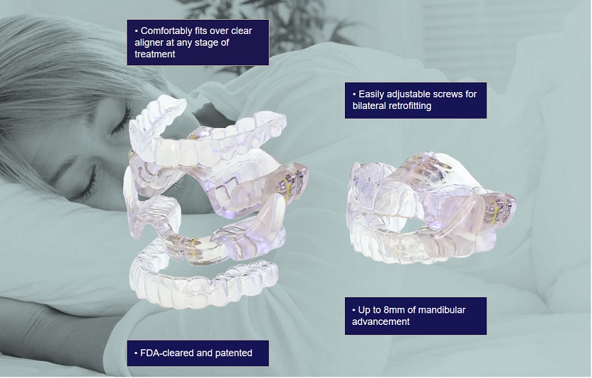 Oral Appliance Therapy with clear aligners
